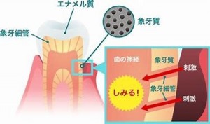歯がしみる 原因と対処法 公益社団法人神奈川県歯科医師会